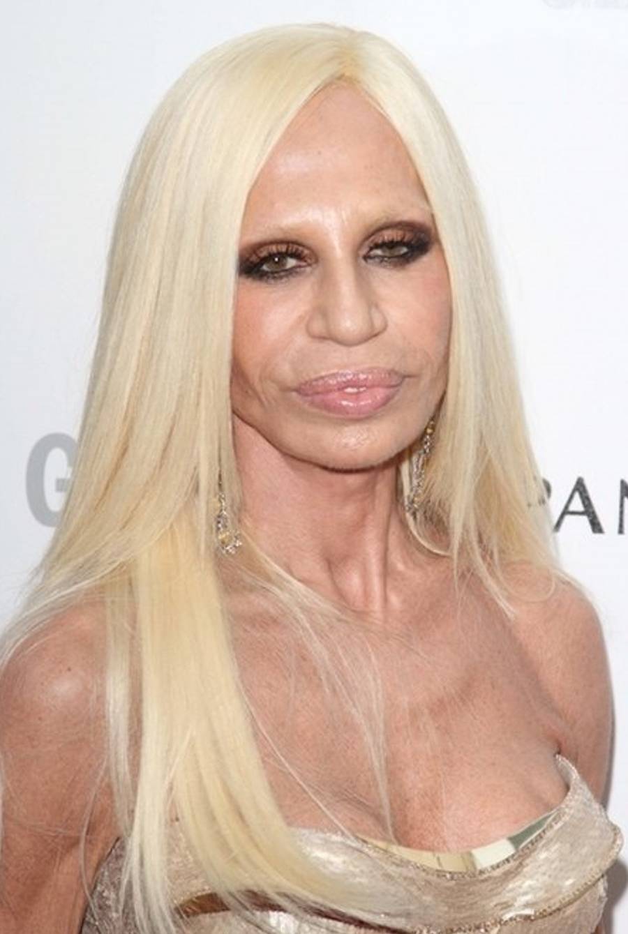 Donatella Versace SZOKUJE nową twarzą! Przebiła metamorfozę Lindsay Lohan (FOTO)