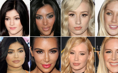 Zdjęcia gwiazd przed i po operacjach plastycznych