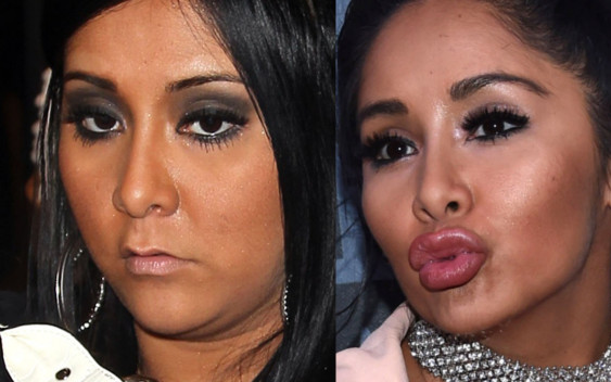 Gwiazdy, które trudno rozpoznać bo NAPOMPOWAŁY usta