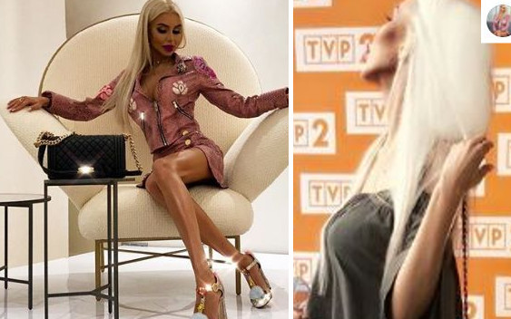 Anella strzeliła FOCHA: Czuję się urażona przez Panią Dr