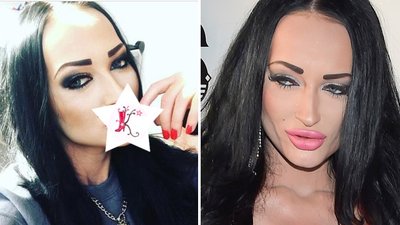 OMG! Co się stało z USTAMI Małgorzaty Godlewskiej?! (Instagram)