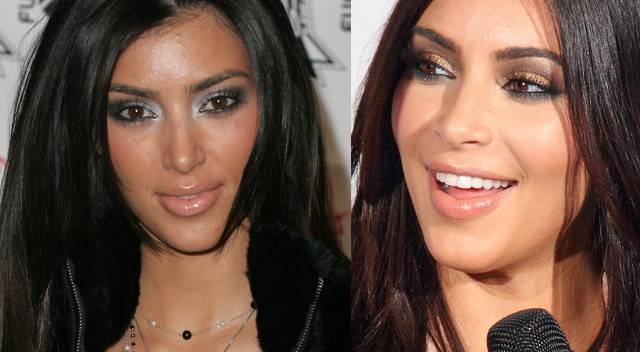 Jakich zabiegów urodowych żałują gwiazdy?