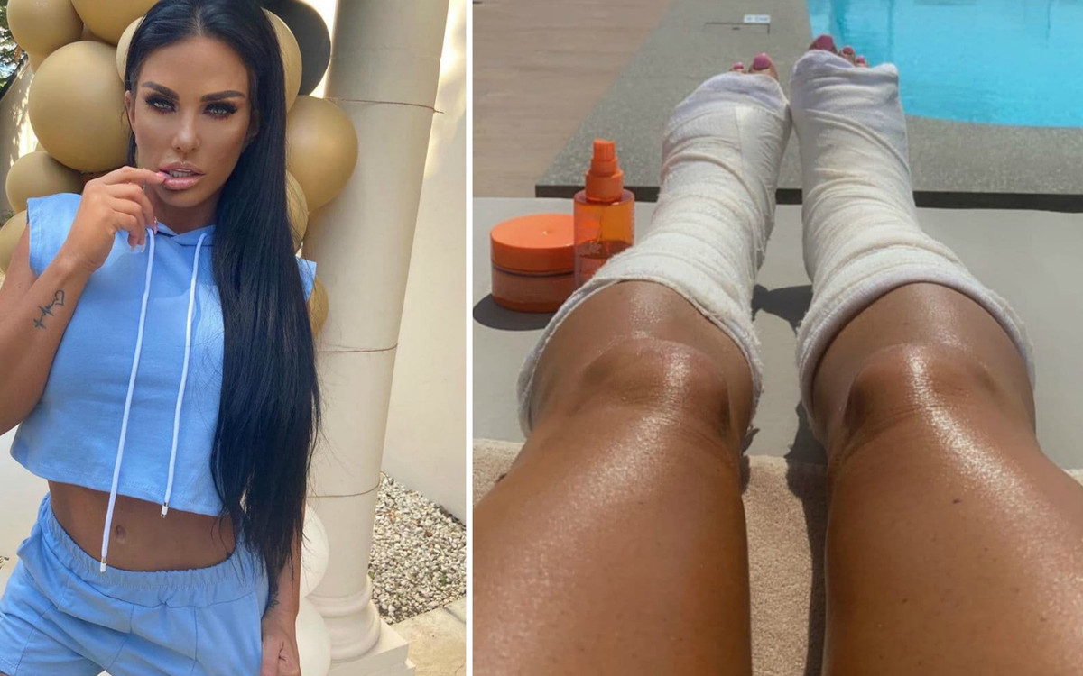Katie Price ma ZŁAMANE dwie nogi! Jest nagranie ze szpitala