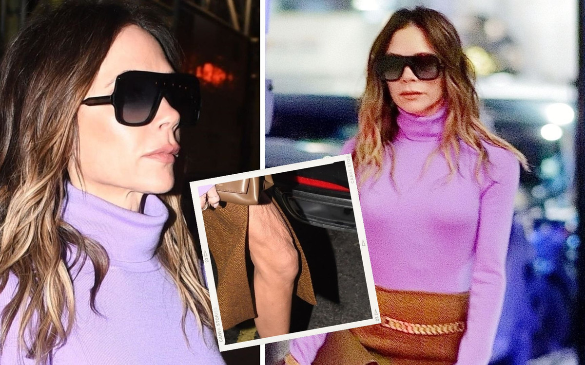 Co stało się z nogą Victorii Beckham? Dziś wszyscy patrzą na TO zdjęcie