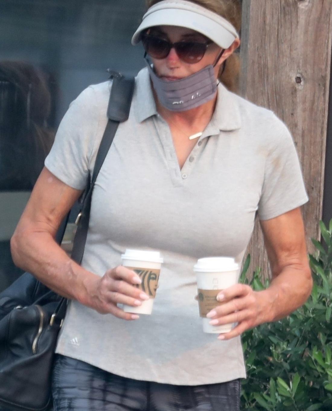 Caitlyn Jenner ze zmianą na nosie, fot. RMBI / BACKGRID / Backgrid USA / Forum