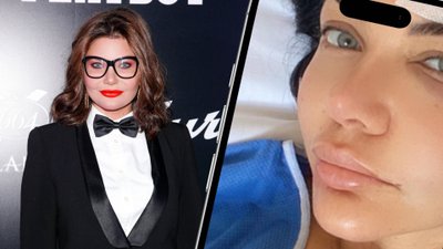 Wodzianka trafiła do szpitala. Pokazała dramatyczne zdjęcie. “Miałam składane kości czaszki”