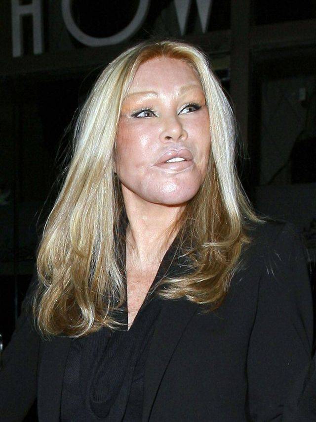 Jak wyglądała kobieta – kot przed operacjami? Dlaczego chciała zostać kotem?