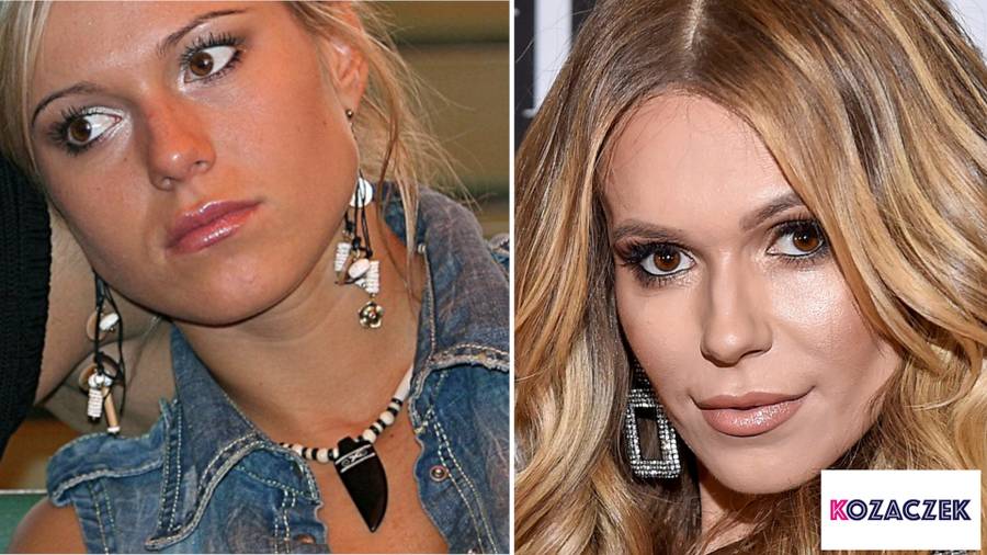 Które polskie gwiazdy powiększały usta? Porównujemy zdjęcia – STARE i NOWE