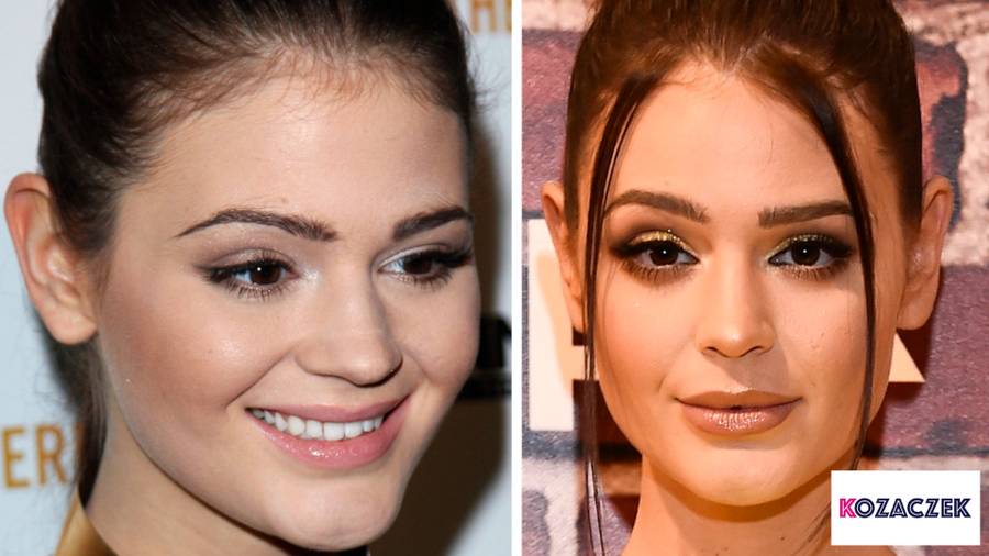 Które polskie gwiazdy powiększały usta? Porównujemy zdjęcia – STARE i NOWE