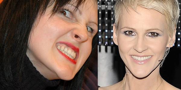 Jak zęby zmieniły twarze gwiazd