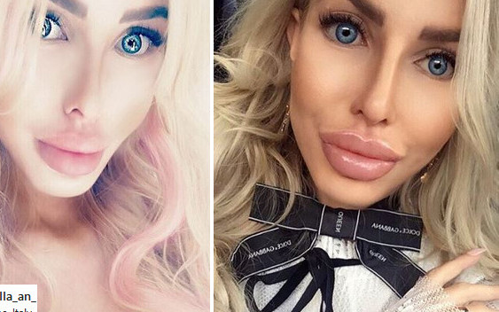 Tak wyglądała polska Barbie PRZED OPERACJAMI. Nie poznacie jej!