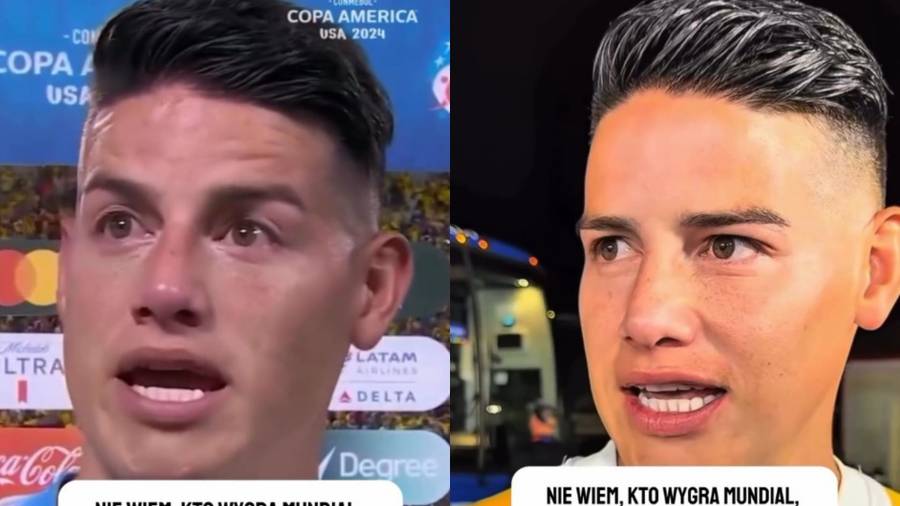James Rodriguez, Piłkarze przed i po botoksie, fot. Instagram