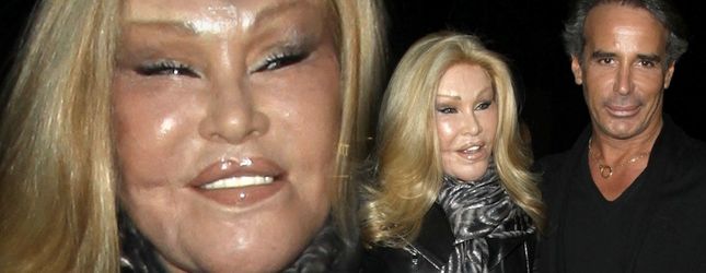 jocelyn-wildenstein-R1