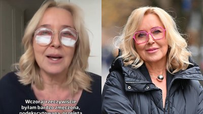 Agata Młynarska przeszła blefaroplastykę. “Nie ma na co czekać”