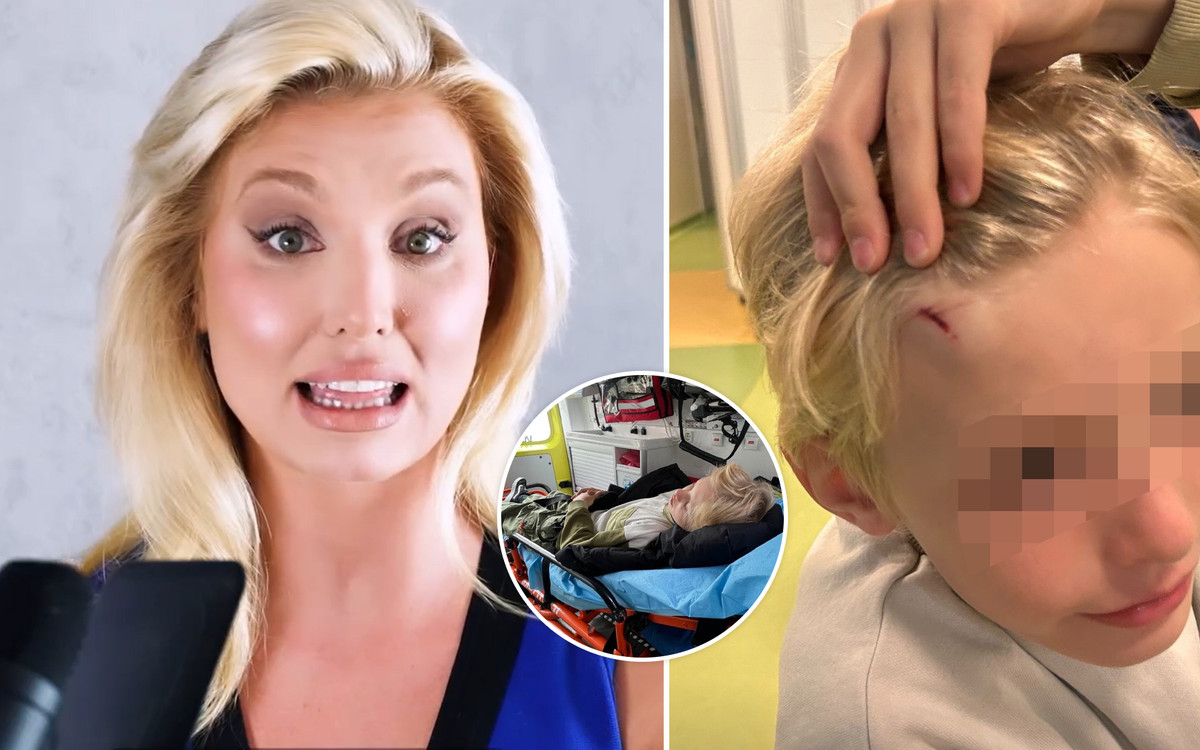 Pajączkowska w ogniu krytyki! Pokazała zdjęcie syna w karetce z rozciętą głową, teraz się tłumaczy