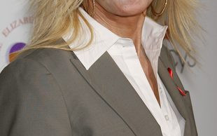 Joan Van Ark powinna zwolnić chirurga i makijażystę