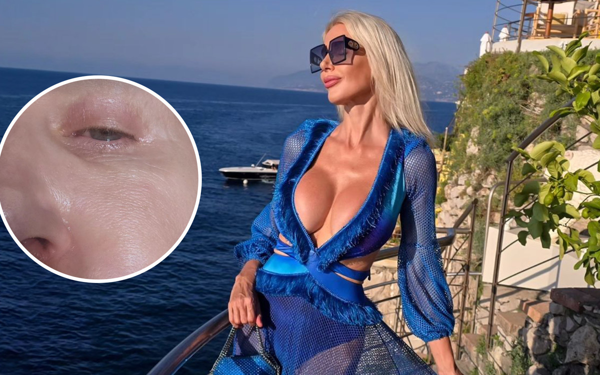 Aneta Glam przeżywa KOSZMAR na wakacjach! “Obudziłam się ze zdeformowaną twarzą”