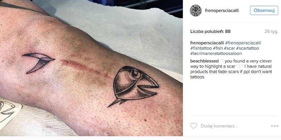 Tatuaże, które kamuflują blizny