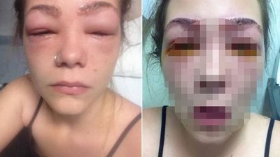 Po użyciu bardzo popularnego kosmetyku stało się jej TO