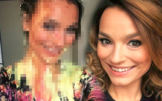 Starmach obsmarowana papką. Fani: marnotrawstwo jedzenia!