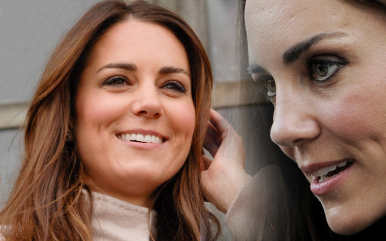 Chirurg plastyczny o tym, co poprawiła sobie księżna Kate