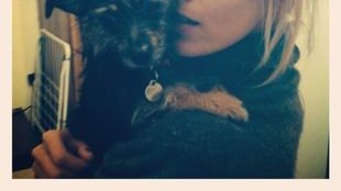 Anja Rubik pokazuje szramę na piersi (FOTO)