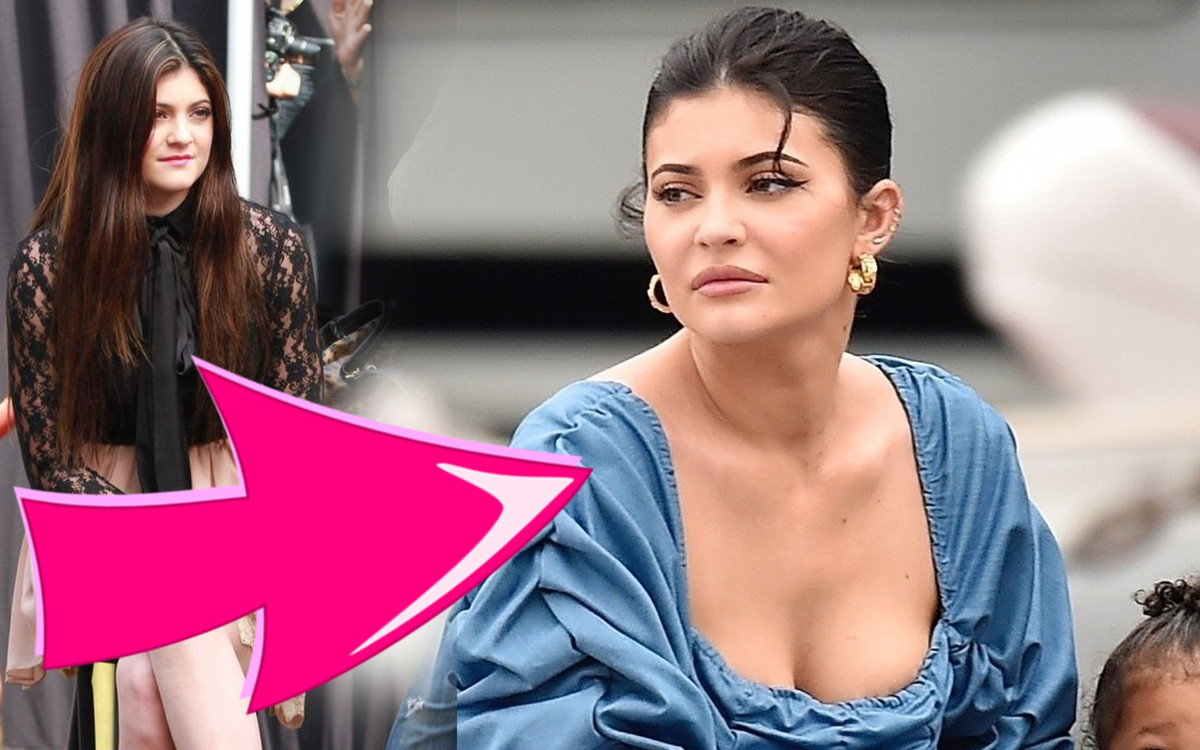 Dlaczego Kylie Jenner wygląda na 10 lat starszą? Influencerka zdradza, jakim ZABIEGOM się poddała