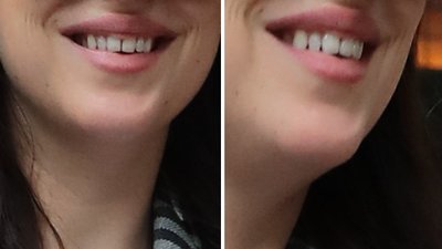 Rodzice – znani aktorzy nie zadbali o ortodontę dla córki? (ZDJĘCIA)