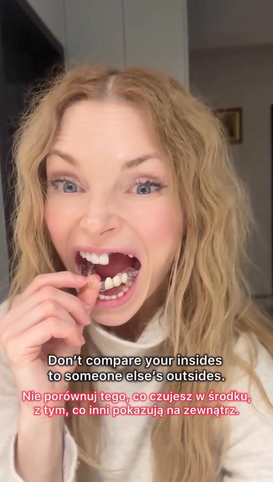 Izabella Miko pokazała prawdziwy uśmiech, fot. Instagram