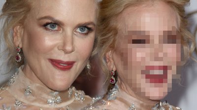 Ten moment, gdy Nicole Kidman próbuje się uśmiechnąć (FOTO)