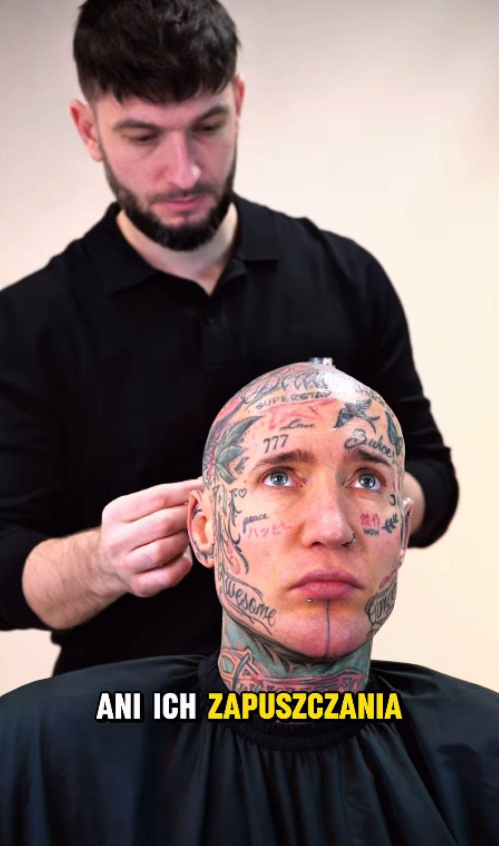 Stifler metamorfoza/Instagram/stifler16cm/hairline.com.pl